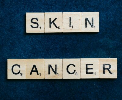 Skin Cancer – A Comprehensive Guide: Causes, Risks, Types, Symptoms, Stages, Treatments, And Side Effects